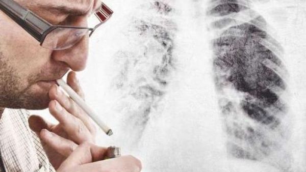 吸电子烟肺会变黑吗？